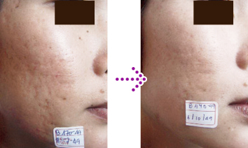 BEFORE → AFTER pinklao clinic