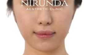 NIRUNDA Clinic