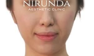 NIRUNDA Clinic