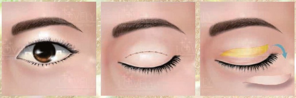 Lovely Eye & Skin Clinic Lovely Eye & Skin Clinic