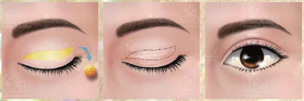 Lovely Eye & Skin Clinic Lovely Eye & Skin Clinic