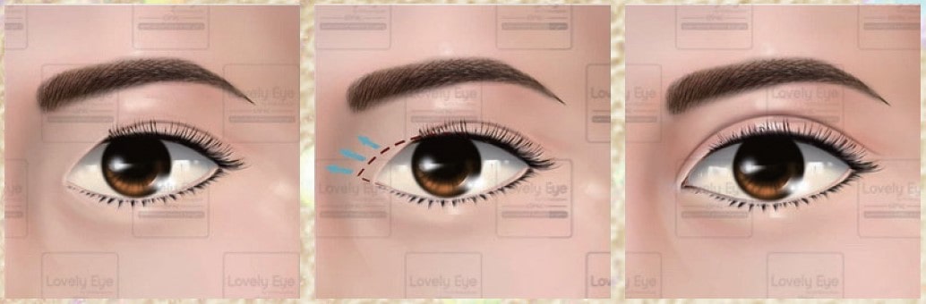 Lovely Eye & Skin Clinic