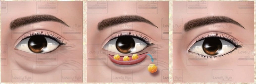 Lovely Eye & Skin Clinic