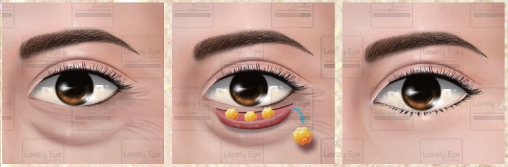 Lovely Eye & Skin Clinic Lovely Eye & Skin Clinic